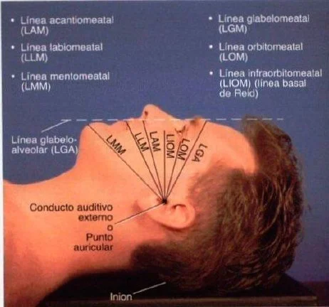 Lineas de referencias para un correcto posicionamiento