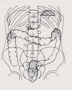 abdomen simple patologico