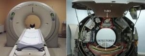 Equipo de Tomografia computadorizada