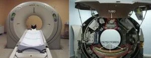 Equipo de Tomografia computadorizada