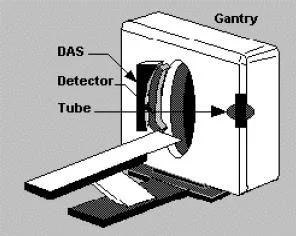 Gantry de Tc
