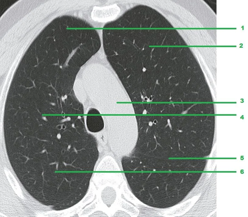 Lungs and Interstitial Network