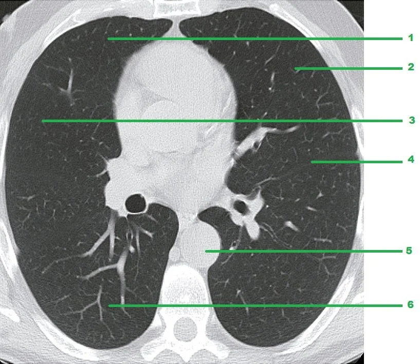 Lungs and Interstitial Network