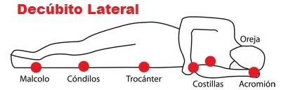Posición Decúbito Lateral